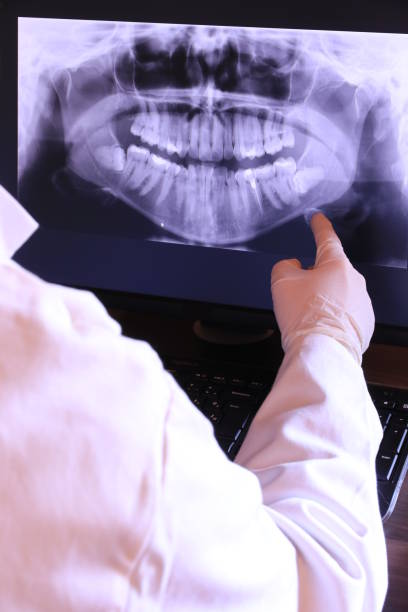 Best Emergency Broken Tooth Repair in Redwood Falls, MN